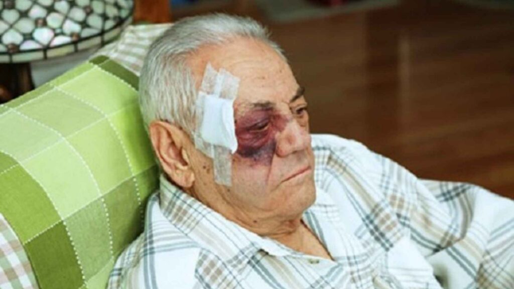 Facial Injuries Can Have a Big Impact on Crash Victims