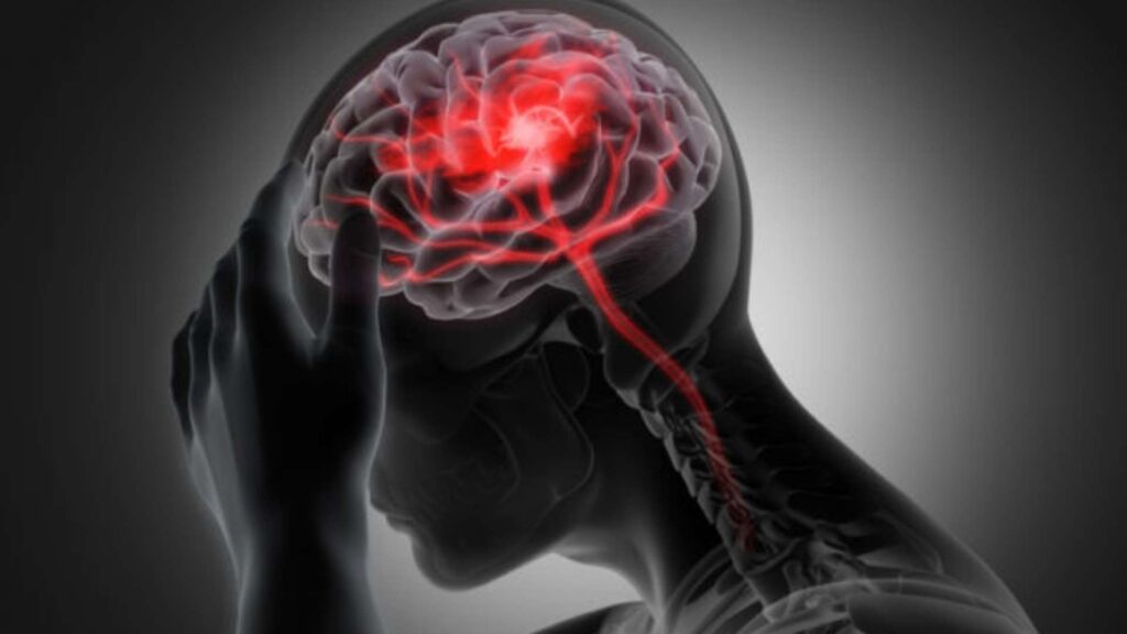Traumatic Brain Injuries Are Often the Result of Negligence