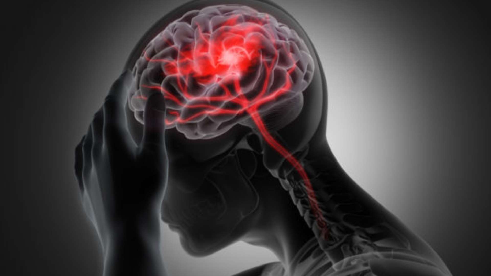 Traumatic Brain Injuries Are Often the Result of Negligence
