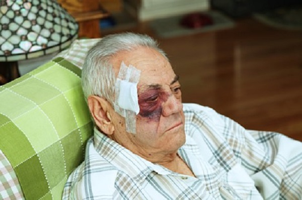 An older man sitting in a green chair with a large bandage covering the side of his face. He has a very big bruise around his eye.