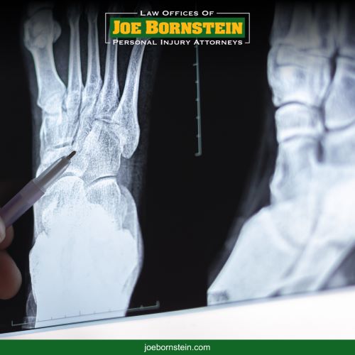 A doctor in Maine reviews an injury victim's x-rays in the aftermath of their accident