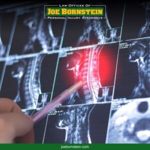 A doctor pointing to a neck injury on an xray, resulting from a Portland accident